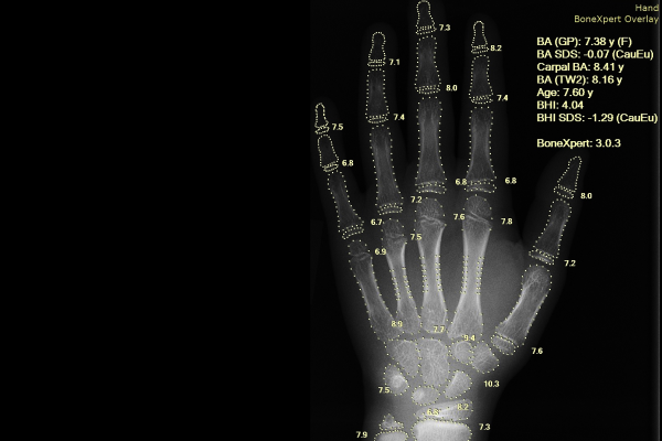 AI reads x-ray